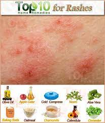 8 Home Remedies For Rashes On Skin Essential Oils More Home Remedies For Rashes Rashes Remedies Natural Home Remedies