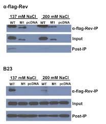 Identification of Nucleolar Factors During HIV-1 Replication Through Rev  Immunoprecipitation and Mass Spectrometry | Protocol (Translated to Arabic)