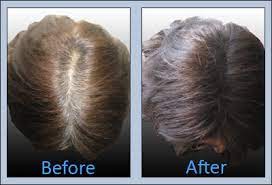 But following are the most common natural cures for treating grey hair. Hair Care Home Remedies For Curing Grey Hair In Urdu Hindi Dailybased
