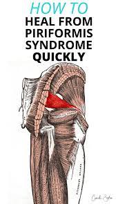 See full list on health.harvard.edu How To Heal From Piriformis Syndrome As Quickly As Possible