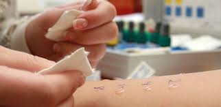 Is there a history of allergies in the family? The Overuse Of Allergy Tests They Could Do More Harm Than Good The Atlantic