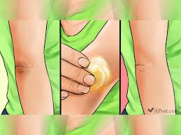 In people with dark elbows, the skin surrounding the elbow is darker than that on the rest of the arm. How To Remove Dark Knees And Elbows In 10 Natural Ways