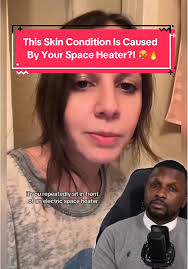 @Alexandra Sedlak Ever notice a weird, net-like rash