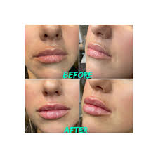 Raleigh Skin Care Clinic