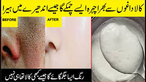 To keep your skin looking youthful, things like drinking lots of water and eating healthy are a good start. Beauty Tips In Hindi Justnewsviews