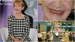 Paní dana se do proměny přihlásila přes kamarádku, která ji u nás už podstoupila. Zkazeny Chrup Daniely Kolarove Co Na To Dentista Naprava By Vysla Velmi Draze Expres Cz