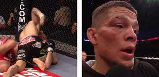 Hd wallpapers and background images. Fight Doctor Nate Diaz S Right Eyebrow And The 80 Rule