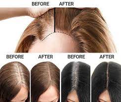 Sevich Hairline Root Touch Up Powder Glamtouche Brown Hair Powder Hairline Roots Hair
