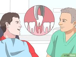 We did not find results for: 3 Ways To Fix An Underbite Wikihow