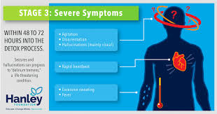 Image result for Alcohol Withdrawal