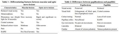 Image result for Decreased Visual Acuity