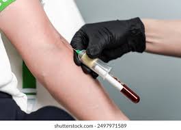 Image result for Venous Blood Sampling