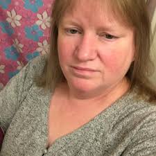 I was taking a shower and getting ready to leave to go to a surgery when my  machine or my Dexcom showed me an error it failed right after I took a