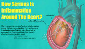 It causes inflammation, swelling, and pain in and around the joints and other body organs ra is an autoimmune disease. How Serious Is Inflammation Around The Heart