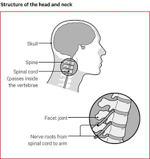 You may have tension headaches, where the pain can travel to the back of your head and sometimes into your ear or behind your eye. Neck Pain Causes Exercises Treatments Versus Arthritis