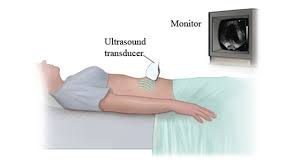 It's often the screening method of choice for detecting an abdominal aortic aneurysm, a weakened, bulging spot in your abdominal aorta, the artery that runs through the. Pelvic Ultrasound Scan Chennai