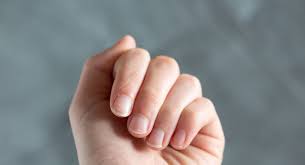 Wie Weisse Flecken Auf Den Fingernageln Entstehen We Go Wild