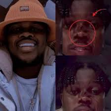 Let's pray for Murdah Bongz 😢💔 DJ Zinhle's husband, Murdah Bongz leaves  fans seriously worried after emotional breakdown & bl00dy nose video  Watch👉https://southafrican-news.com/fans-deeply-concerned-after-emotional-video-of-murdah-bongz-surfaces/