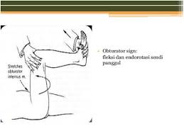 Jika ada ruam muncul di badan anda, sila dapatkan rawatan dan. Acute Appendicitis Rsudmangusada Badungkab Go Id