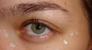 Goz Alti Kirisiklik Kremi Ozellikleri Ve Faydalari Kirisiklik Gen Tr