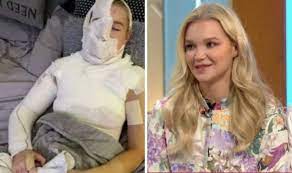 Abbie quinnen, 23, has admitted her relationship with former strictly come dancing professional aj pritchard, 26, was impacted when she suffered a horrific fire accident at the beginning of this year. T3uzns3sc9ijqm