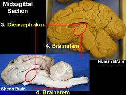 Check spelling or type a new query. Comparing The Sheep Brain To The Human Brain