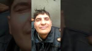 Kaynak Almis Goze Acil Mudahale Youtube