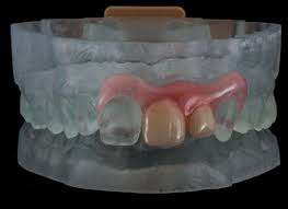 popular rumor has it that george washington s dentures were made out of wood that s actually not true but i wish 3d printing business 3d printing 3d printer