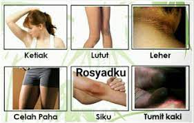 Berbeda dengan kotoran pada umumnya, daki ini cenderung sulit sekali untuk dihilangkan. Cara Menghilangkan Daki Dengan Pelembab Cara Menghilangkan Daki Yang Sangat Membandel Dapat Dihilangkan Secara Alami Menggunakan Minyak Almond Oats Dan Kulit Jeruk Ariani Grande