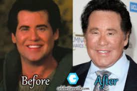 It's an unbelievable achievement to have no wrinkles around the eyes in . Celebritieswith Com All About Celebrity Plastic Surgery