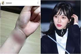 권민아 aoa 탈퇴 이유 언니에게 괴롭히 당해. ê¶Œë¯¼ì•„ Aoa ê´´ë¡­íž˜ í­ë¡œê¸€ ê·¸ ì–¸ë‹ˆ ì§€ë¯¼ì€ ì†Œì„¤ ì¢…í•© ë¨¸ë‹ˆíˆ¬ë°ì´