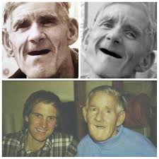 Image result for Joey Deacon