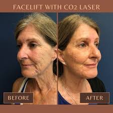 Mark Mcclung's Instagram, Twitter & Facebook