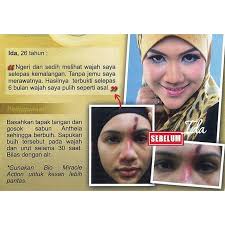 Kandungan putik telaga dara jamu ratu malaya. Set Jeragat Jamu Ratu Malaya Shopee Malaysia