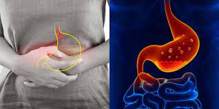 Ketiga, organ seperti indung telur atau rahim dapat merasakan adanya tekanan atau dorongan selama berhubungan seks. Jika Anda Mengalami 5 Tanda Penyakit Gastrik Ini Dalam Badan Dapatkan Rawatan Segera