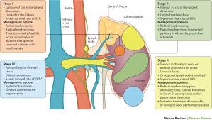 Urethral cancer is the most rare of all urological cancer. Renal Cell Carcinoma Nature Reviews Disease Primers
