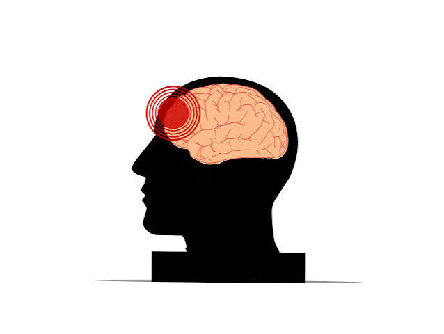 Study suggests depression after traumatic brain injury could represent a  new, distinct disease