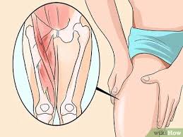 Wissen Ob Du Eine Hernie Hast Mit Bildern Wikihow