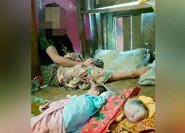 Proses terjadinya bayi kembar tergantung dari berapa banyak sel telur yang dibuahi. Hanya Ada Kepala