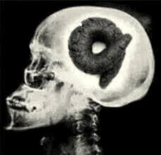 X-rays poop brains #4 Blank Template ...