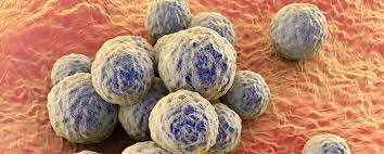 Bakterien der art staphylococcus aureus kommen auf der haut und den schleimhäuten von vielen gesunden menschen vor. Staphylococcus Aureus 2020 Symptome Ubertragung Behandlung