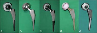 Maybe you would like to learn more about one of these? Recent Updates For Biomaterials Used In Total Hip Arthroplasty Biomaterials Research Full Text