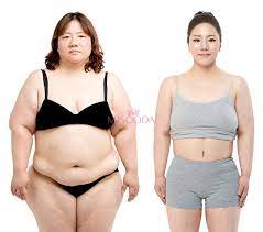 Check spelling or type a new query. Why Korean Body Contouring Surgery Guide Reviews Promotions Misooda