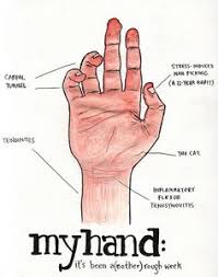 7 Diy Carpal Tunnel Treatments Ways To Avoid Surgery For Carpal Tunnel Carpal Tunnel Exercises Carpal Tunnel Surgery Carpal Tunnel Syndrome
