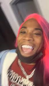 Shamar partnered up with zeus to get his teeth done 😁🥺❤️ he deserves  this‼️ Videos in comments