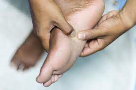 Plantar fibromatosis is often painless but, depending on the location and size of the. Plantar Fibroma Treatment Symptoms And Causes