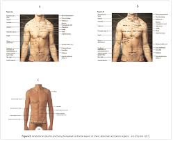 Anatomical Sites For Practicing Wet Cupping Therapy Al