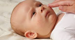 Eczema is a chronic skin condition which is characterized by dry skin, red patches, and itchiness. Baby Eczema Symptoms Causes Treatments Creams And More