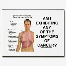 If you have been diagnosed with adenocarcinoma cancer, you have a cancer that developed in one of the glands that lines the inside of your organs. Pin On Mesothelioma