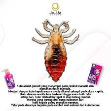 Doc koyakkan hujung peket ubat kutu tadi dan picit ubat tu pada belakang leher (tengkuk) mika kemudian ratakan sampaikan ke kulit. Shampoo Kutu Jajja Chinta Ubat Kutu Paling Berkesan Free Sikat Kutu Shopee Malaysia